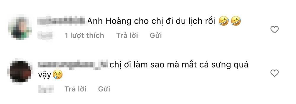 Tóc Tiên gây lo lắng vì chân sưng vù trong ảnh tự đăng-5