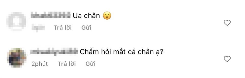 Tóc Tiên gây lo lắng vì chân sưng vù trong ảnh tự đăng-6