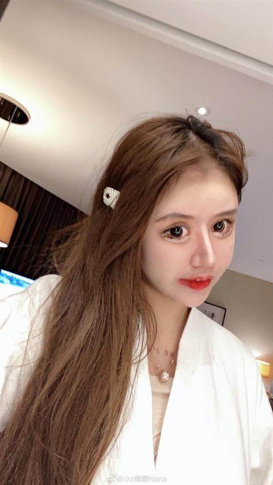 Phẫu thuật năm 13 tuổi, cô gái trưởng thành có mặt đáng sợ-2