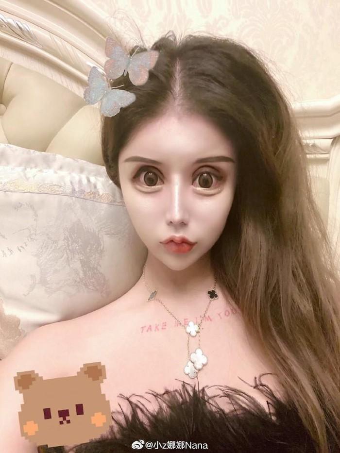 Phẫu thuật năm 13 tuổi, cô gái trưởng thành có mặt đáng sợ-4