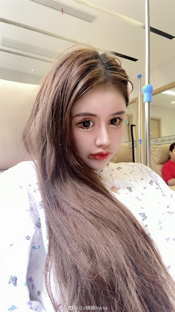 Phẫu thuật năm 13 tuổi, cô gái trưởng thành có mặt đáng sợ-5