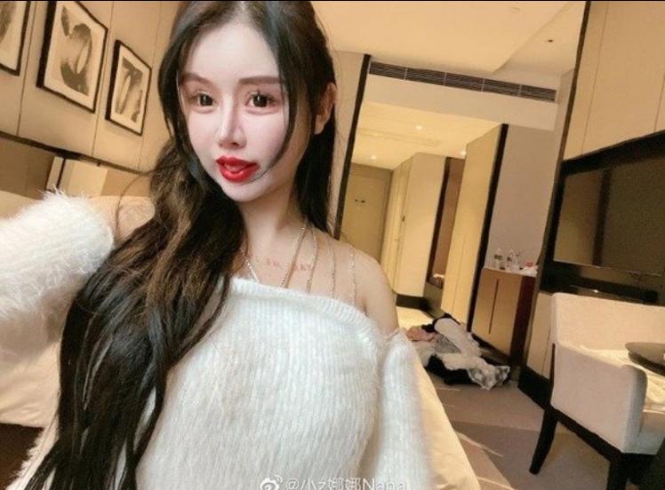 Phẫu thuật năm 13 tuổi, cô gái trưởng thành có mặt đáng sợ-7