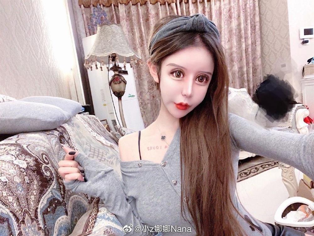 Phẫu thuật năm 13 tuổi, cô gái trưởng thành có mặt đáng sợ-8