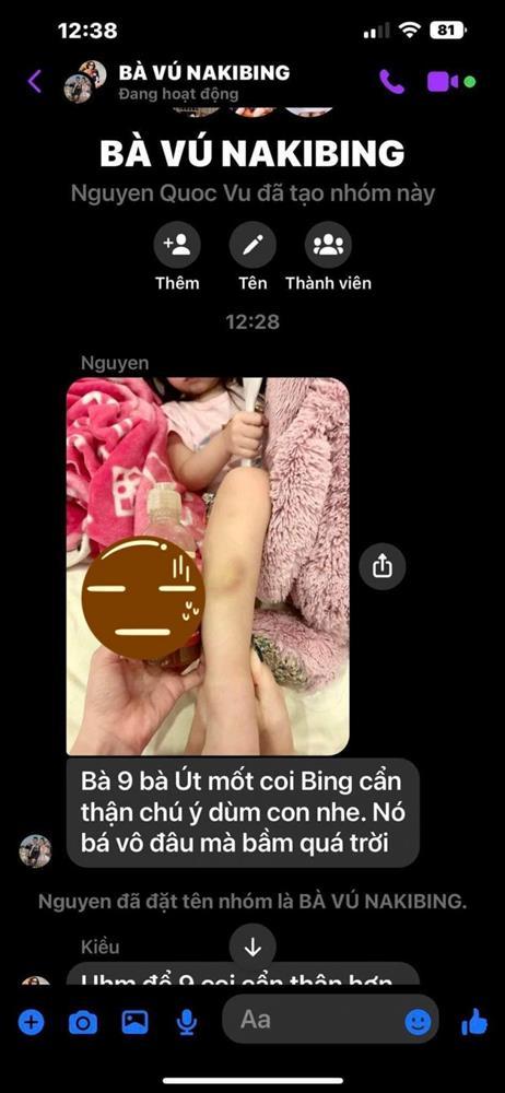Con gái bị bầm tím chân, chồng Đoàn Di Băng lập nhóm chỉnh bà vú-2