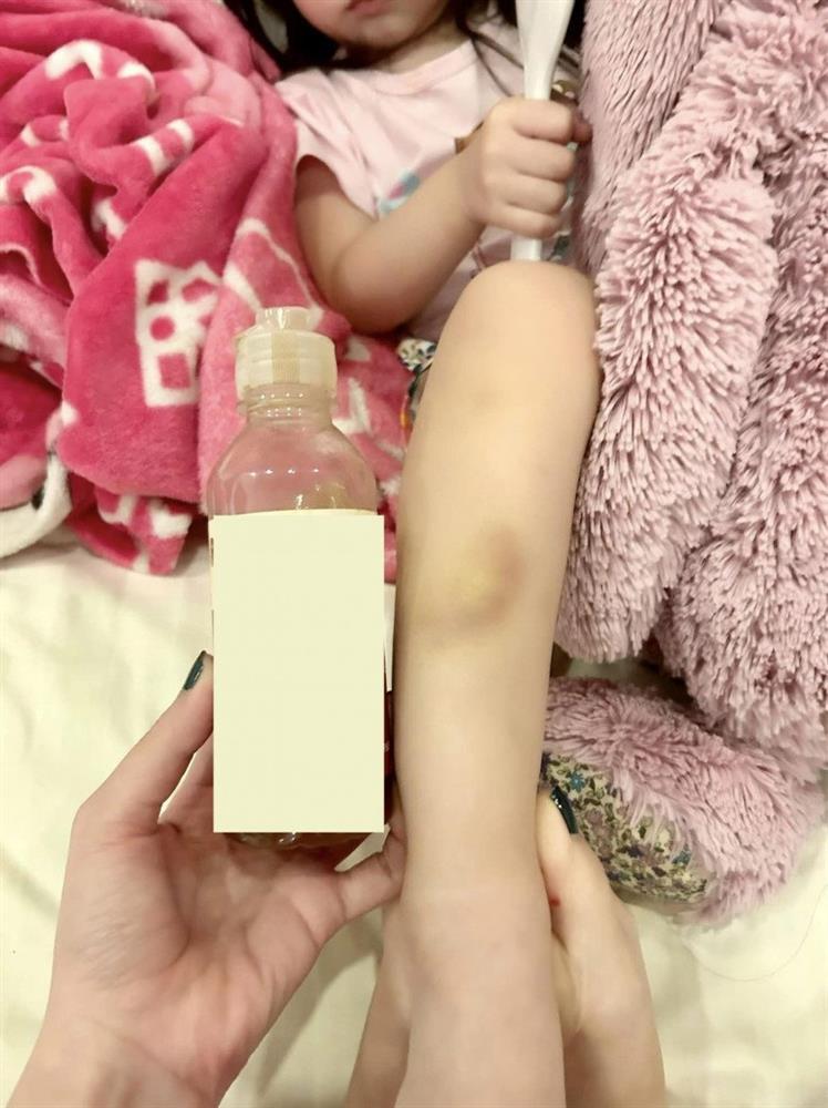 Con gái bị bầm tím chân, chồng Đoàn Di Băng lập nhóm chỉnh bà vú-3