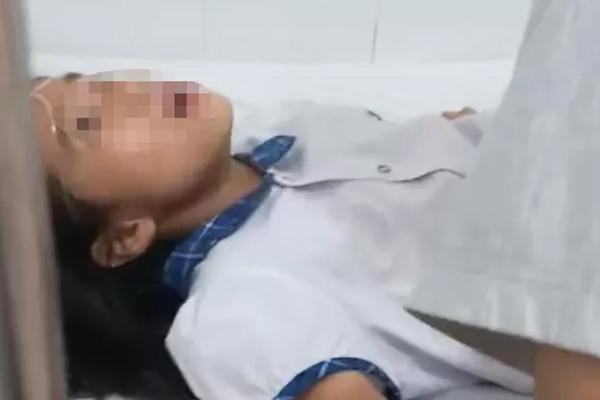 Ăn kẹo người lạ cho, hai học sinh lớp 6 lên cơn co giật, khó thở-1