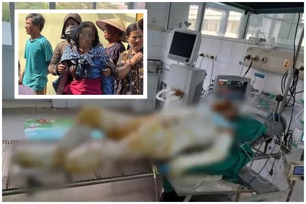 Vụ 3 con gái đốt nhà mẹ: Người mẹ đã 2 lần ghép da nhưng rất yếu-3