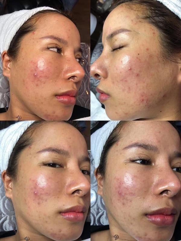 Bà Nhân Vlog lộ mặt mộc, nhan sắc thật có gây sốc?-3