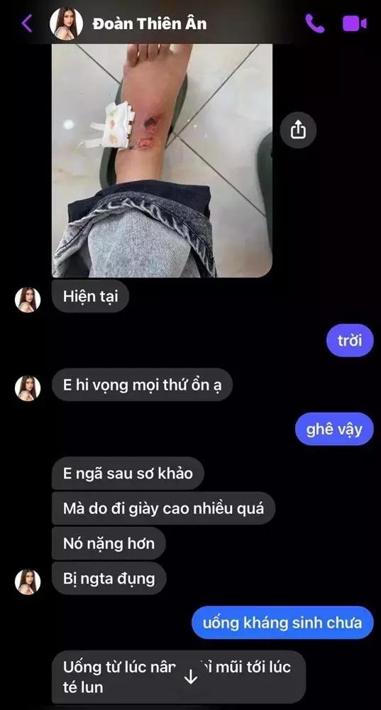 Hoa hậu Thiên Ân quên photoshop vết sẹo lồi thâm đen-10