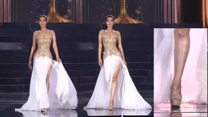 Hoa hậu Thiên Ân quên photoshop vết sẹo lồi thâm đen-11