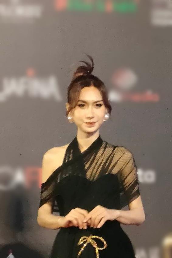 Nhan sắc Lynk Lee qua cam thường sau 8 lần phẫu thuật-2