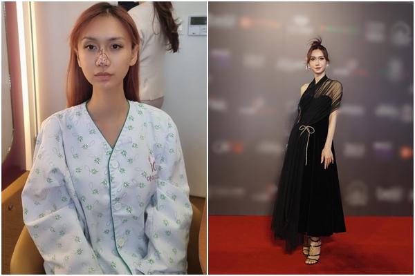 Lynk Lee nói về chiếc mũi nâng bị chê, sửa gì trong 8 lần phẫu thuật-7