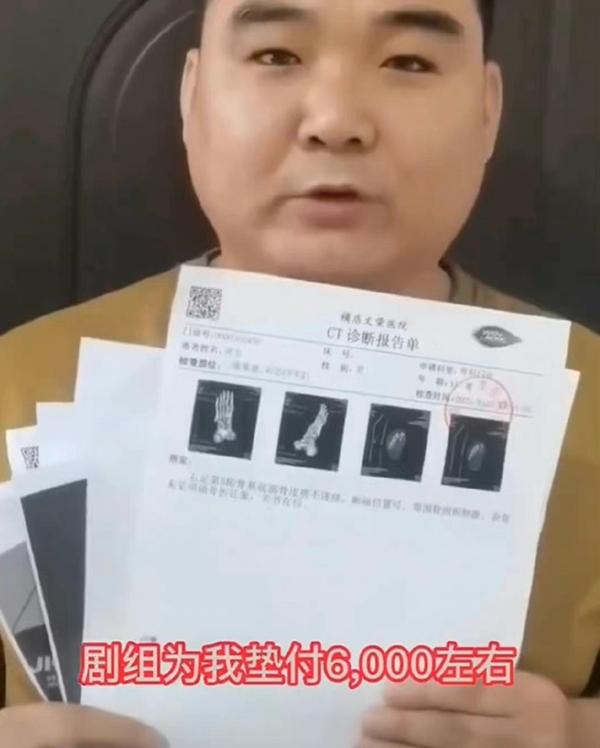 Võ sư chấn thương nhưng đoàn phim của Lưu Thi Thi phớt lờ-2