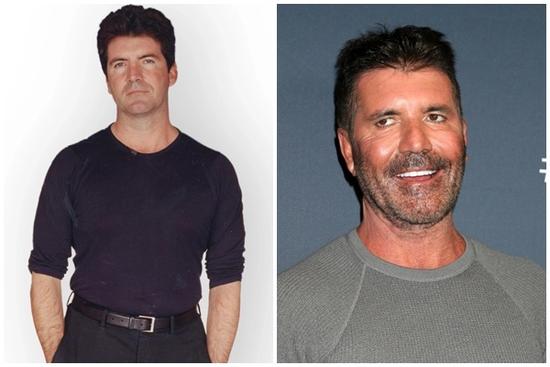 Gương mặt Simon Cowell thay đổi 'không thể nhận ra'