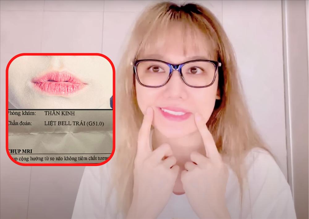 Loạt ca sĩ Việt long đong sự nghiệp vì mắc bệnh nguy hiểm-5