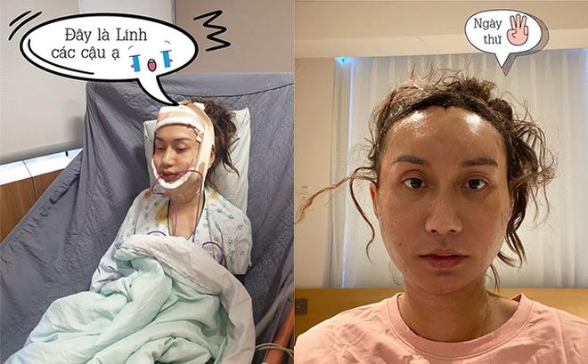 Lynk Lee nói về chiếc mũi nâng bị chê, sửa gì trong 8 lần phẫu thuật-3
