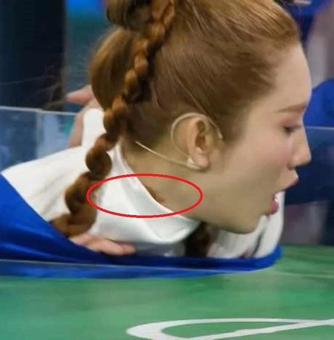 Thúy Ngân bị thương nghiêm trọng ở cổ-2