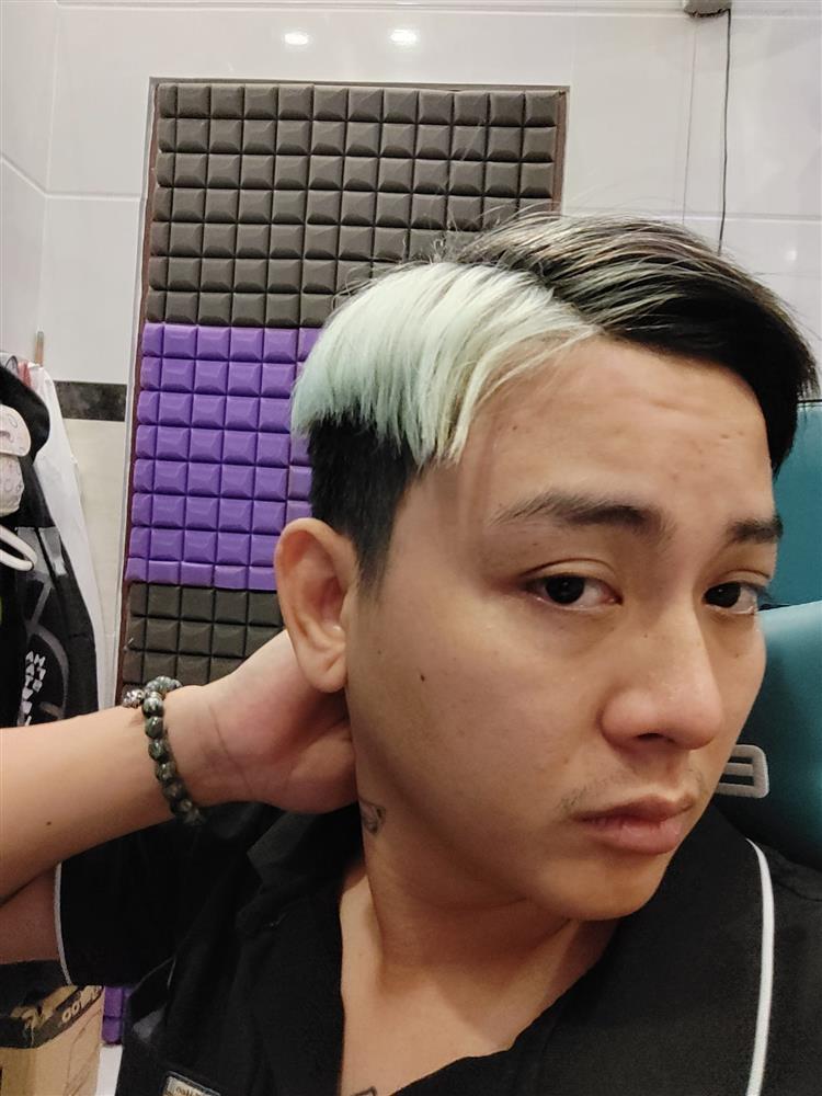 Hoài Lâm đổi màu tóc gắt, gương mặt có sự thay đổi nhẹ-1