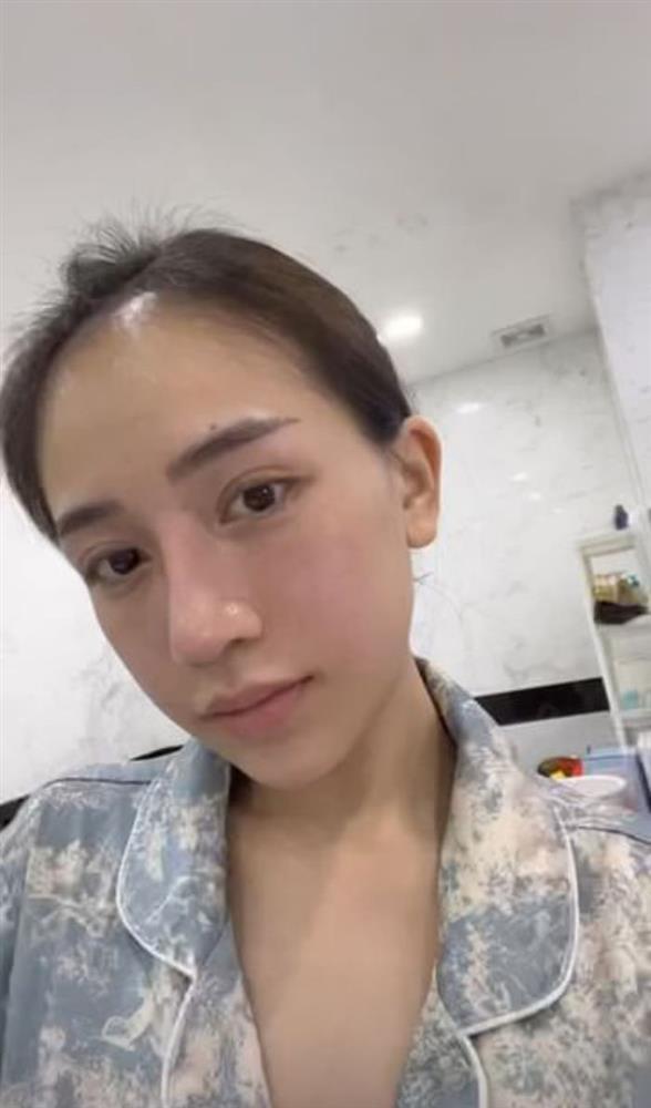 Mặt mộc ái nữ đại gia Minh Nhựa hậu dao kéo như Tây-1