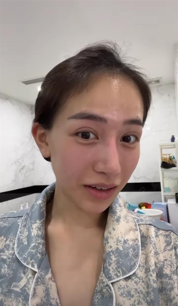 Mặt mộc ái nữ đại gia Minh Nhựa hậu dao kéo như Tây-2