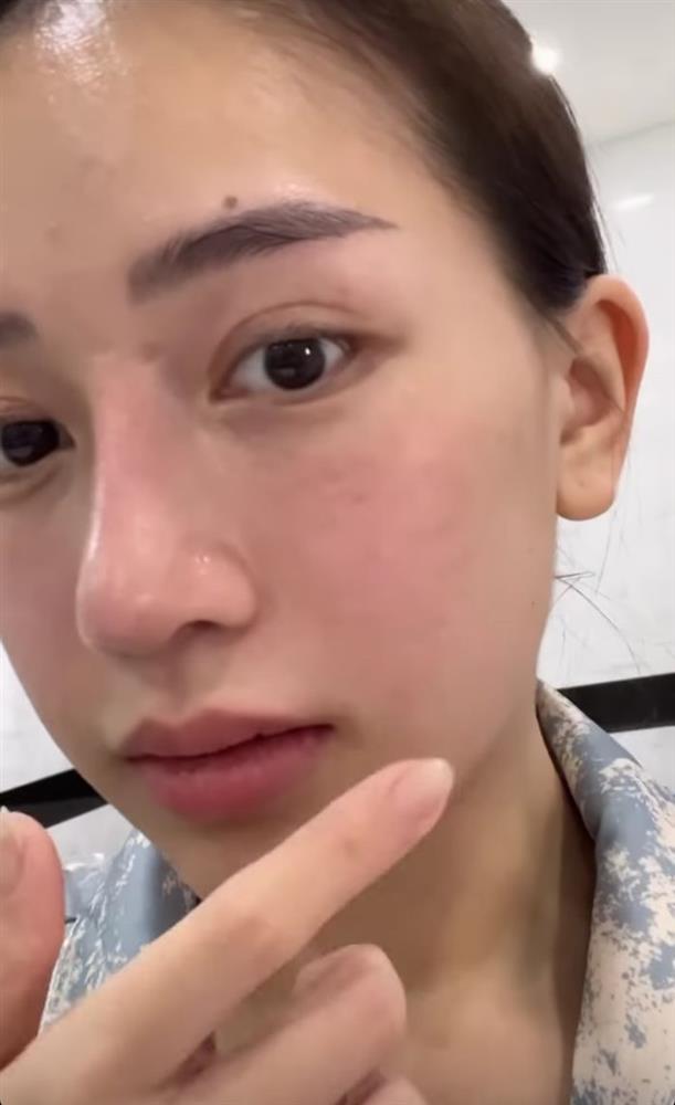 Mặt mộc ái nữ đại gia Minh Nhựa hậu dao kéo như Tây-4