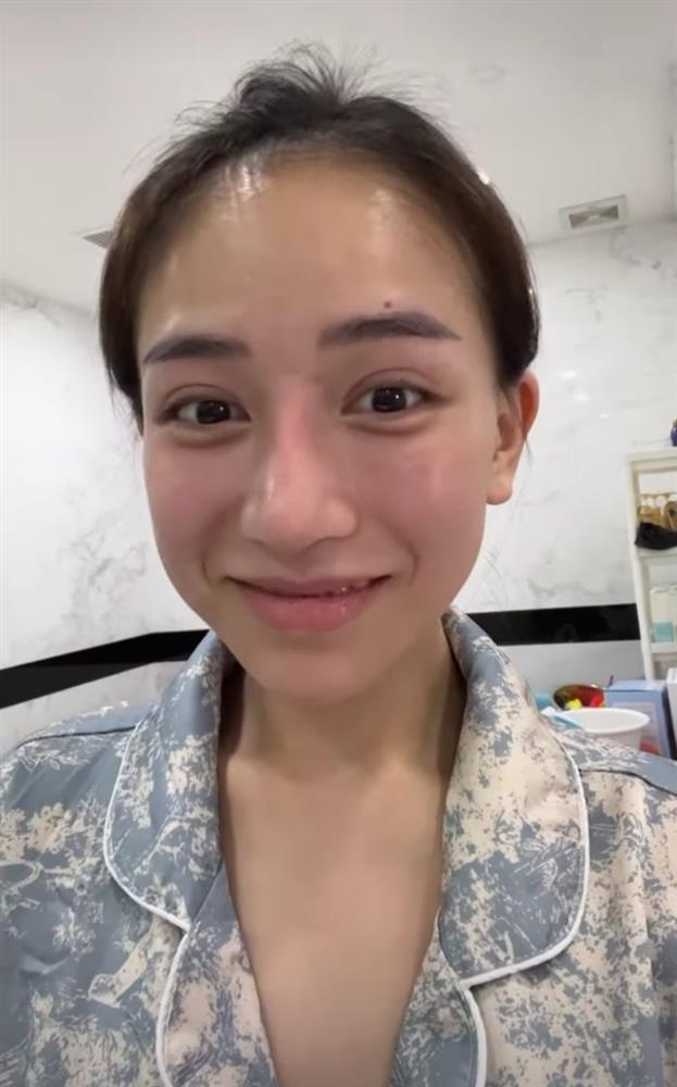 Mặt mộc ái nữ đại gia Minh Nhựa hậu dao kéo như Tây-3