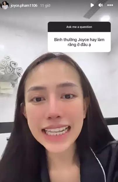 Mặt mộc ái nữ đại gia Minh Nhựa hậu dao kéo như Tây-12