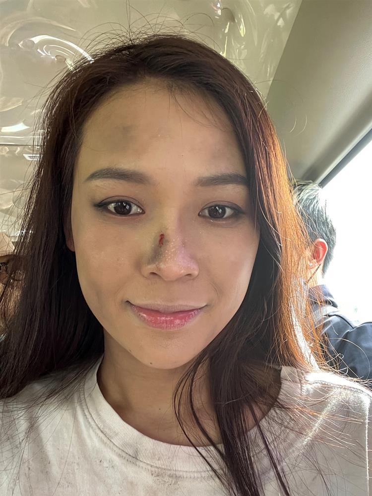 Thót tim cảnh Sam rơi xuống thác nước, mặt bị sưng phù-9