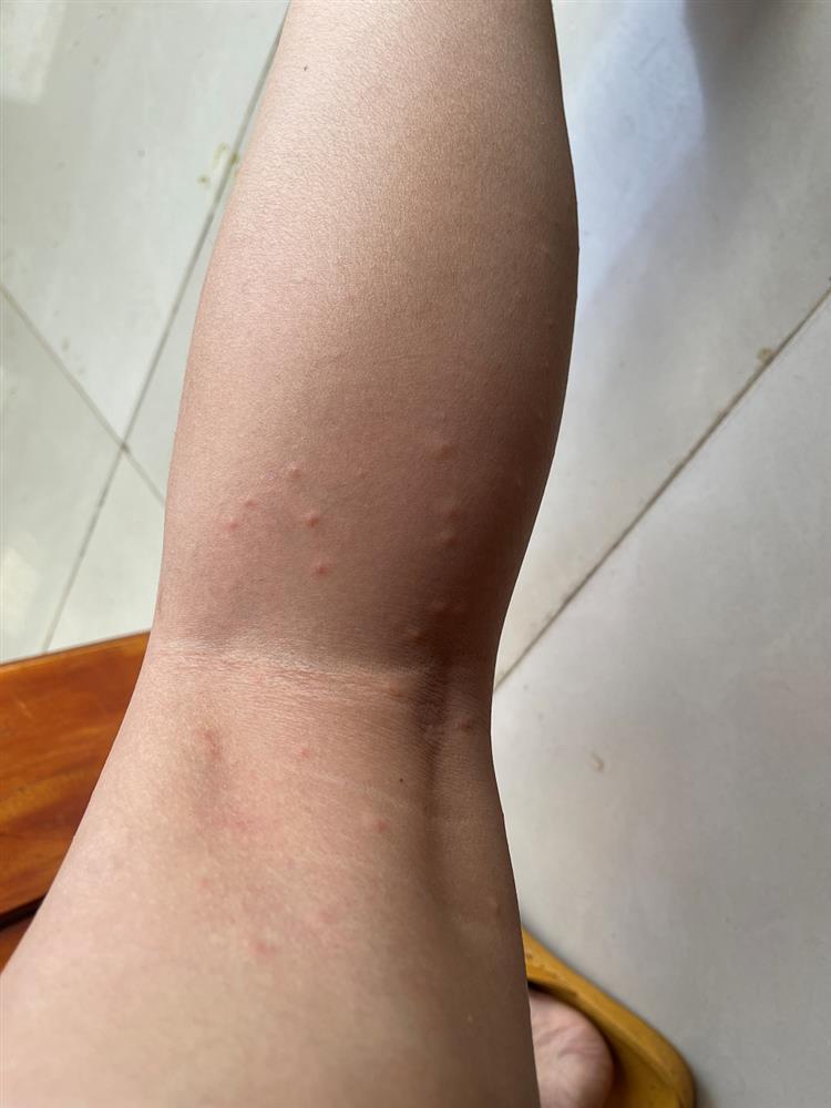 Thót tim cảnh Sam rơi xuống thác nước, mặt bị sưng phù-7