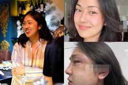 Misoa Kim Anh: Bị bạn trai lừa dối, nhiều lần lụy tình đến nhập viện