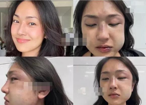 Misoa Kim Anh: Bị bạn trai lừa dối, nhiều lần lụy tình đến nhập viện-1