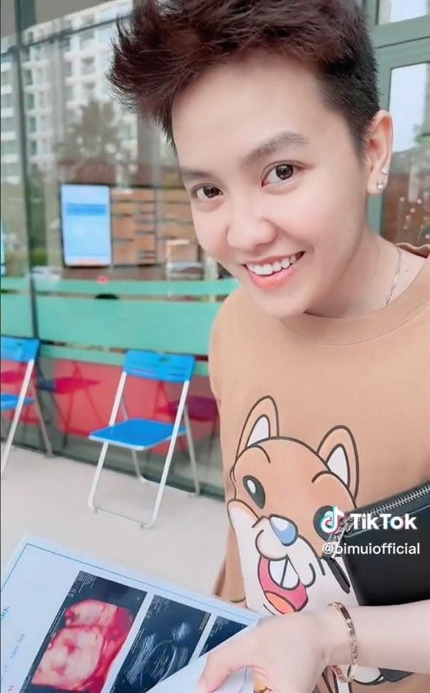 Cặp đồng tính nổi đình đám khoe siêu âm thai, chuẩn bị sinh con-1