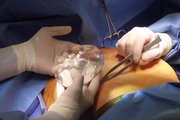 Cô gái tử vong sau khi đốt mỡ cánh tay và ngực ở trung tâm thẩm mỹ-1