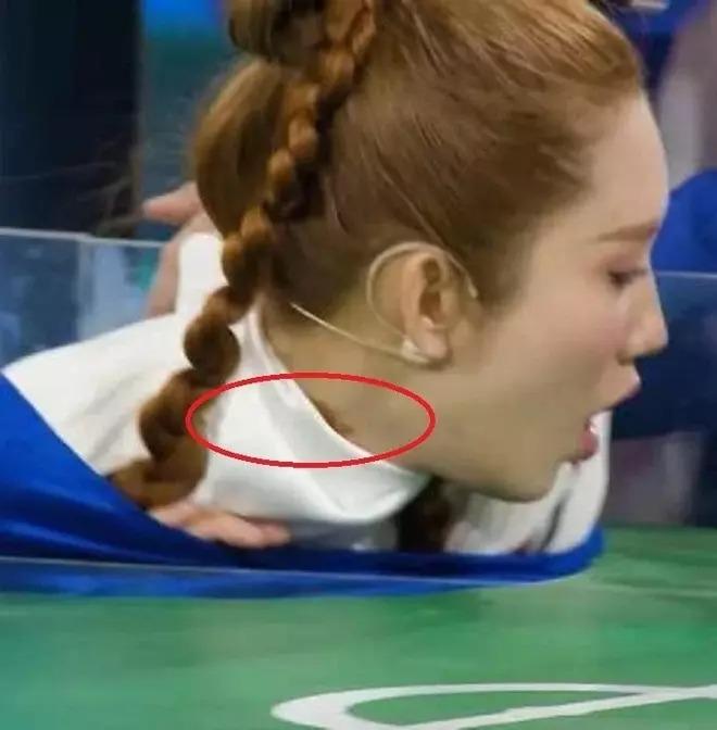 Thúy Ngân tái xuất sau khi bị bỏng nặng ở cổ: Làn da ra sao?-2