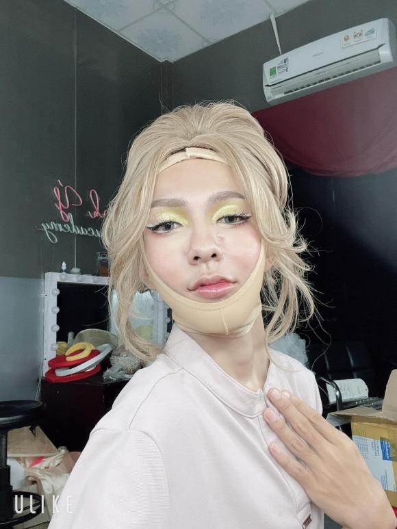 TikToker đình đám Võ Thành Ý dao kéo, giật mình diện mạo hiện tại-4