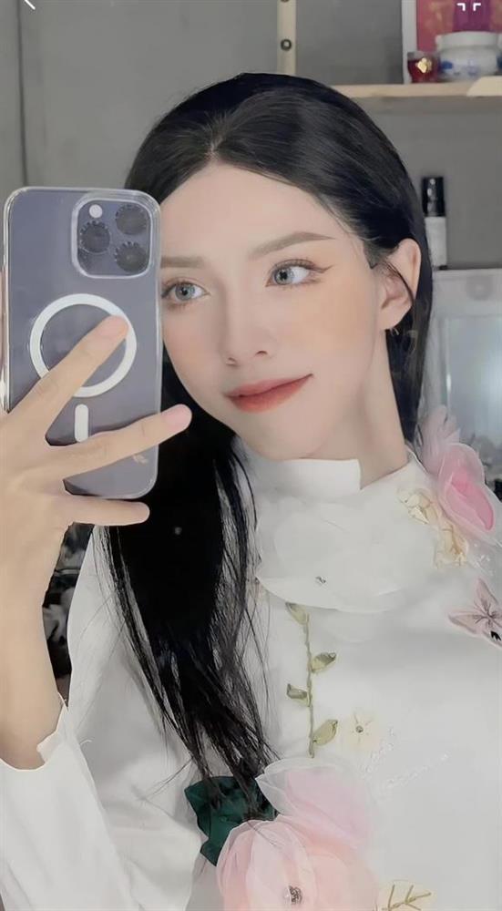 TikToker đình đám Võ Thành Ý dao kéo, giật mình diện mạo hiện tại-2