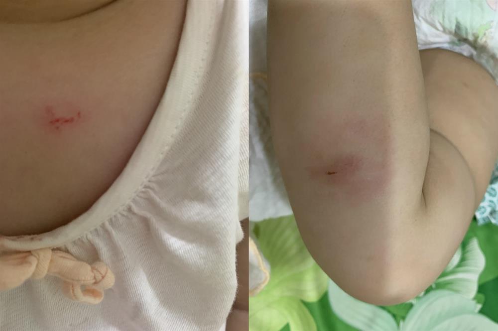 Bé mầm non liên tục cắn nhau, trường cho trẻ nghỉ học vì quá áp lực-1