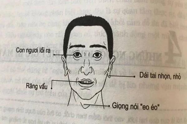 Lông mọc nhiều ở 4 vị trí trời định giàu sang, lộc không cản nổi-3