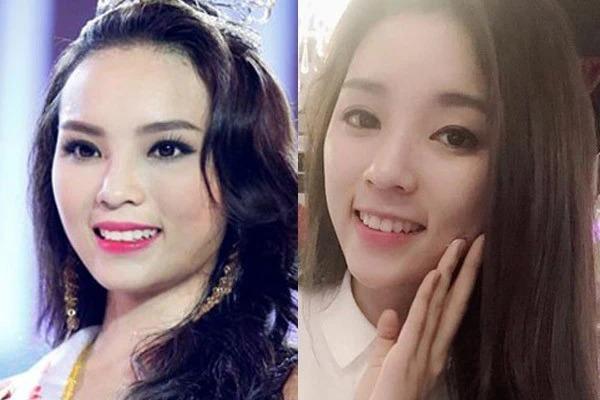 Kỳ Duyên thú nhận thường làm mặt lạnh vì tự ti với nụ cười-6