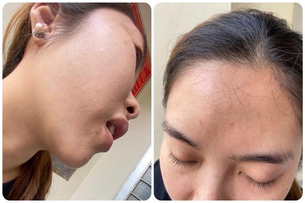 Xôn xao khỉ sổng chuồng ở Thái Bình, tấn công người, cắn vật nuôi-4