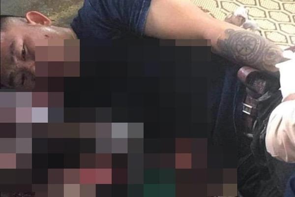 Hãi hùng thanh niên bị nát tay, thủng bụng nghi nổ pháo tự chế-1