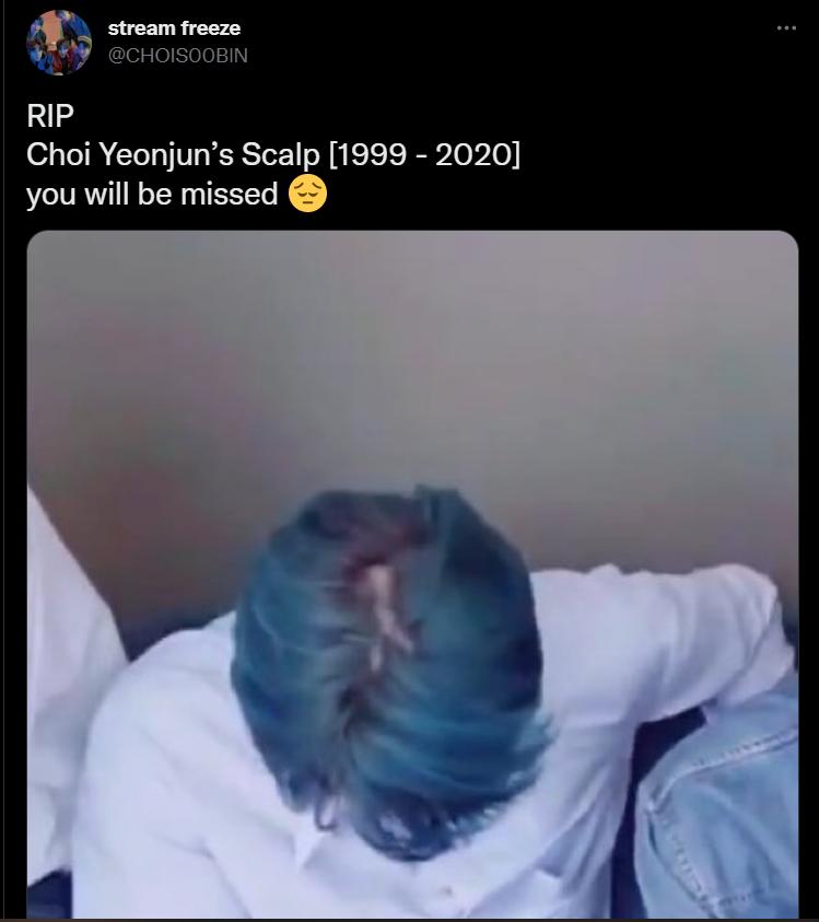 Thành viên nổi hàng đầu TXT gây bão vì có nguy cơ hói đầu-4