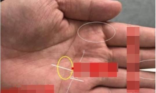 Hình chữ thập trong đường chỉ tay, có trí tuệ và khả năng kiếm nhiều tiền-3