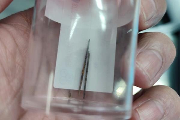 Bất ngờ phát hiện kim khâu nằm trong phổi bé trai 4 tuổi-1