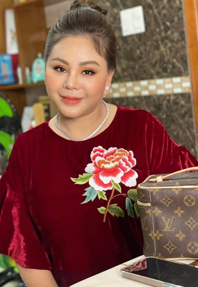 Nghệ sĩ Lê Giang rách giác mạc, tụ máu ở mắt do tai nạn-1