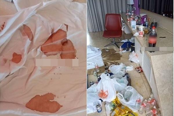 Đi du lịch, chớ dại đụng vào 3 đồ vật trong khách sạn kẻo rước bệnh-4