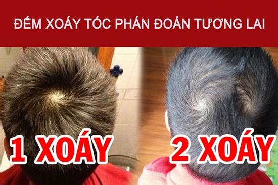 Tương lai ẩn trong xoáy tóc: Mấy xoáy tóc báo hiệu sự giàu có?