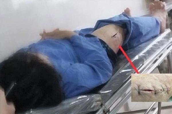 Cán bộ cục thuế bị đâm trọng thương khi đi học chính trị-1