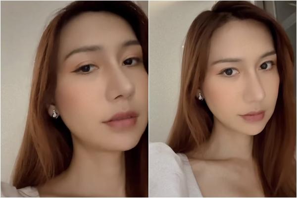 Chiếc mũi gây giật mình của Lynk Lee giờ ra sao sau 1 tháng dao kéo?-3