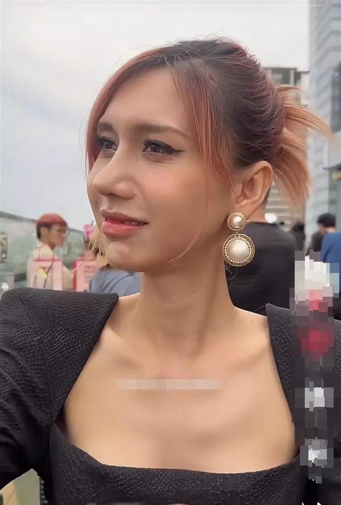 Chiếc mũi gây giật mình của Lynk Lee giờ ra sao sau 1 tháng dao kéo?-1